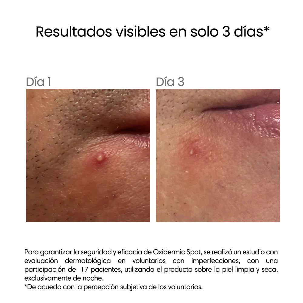 RÉVE Oxidermic spot 5g
