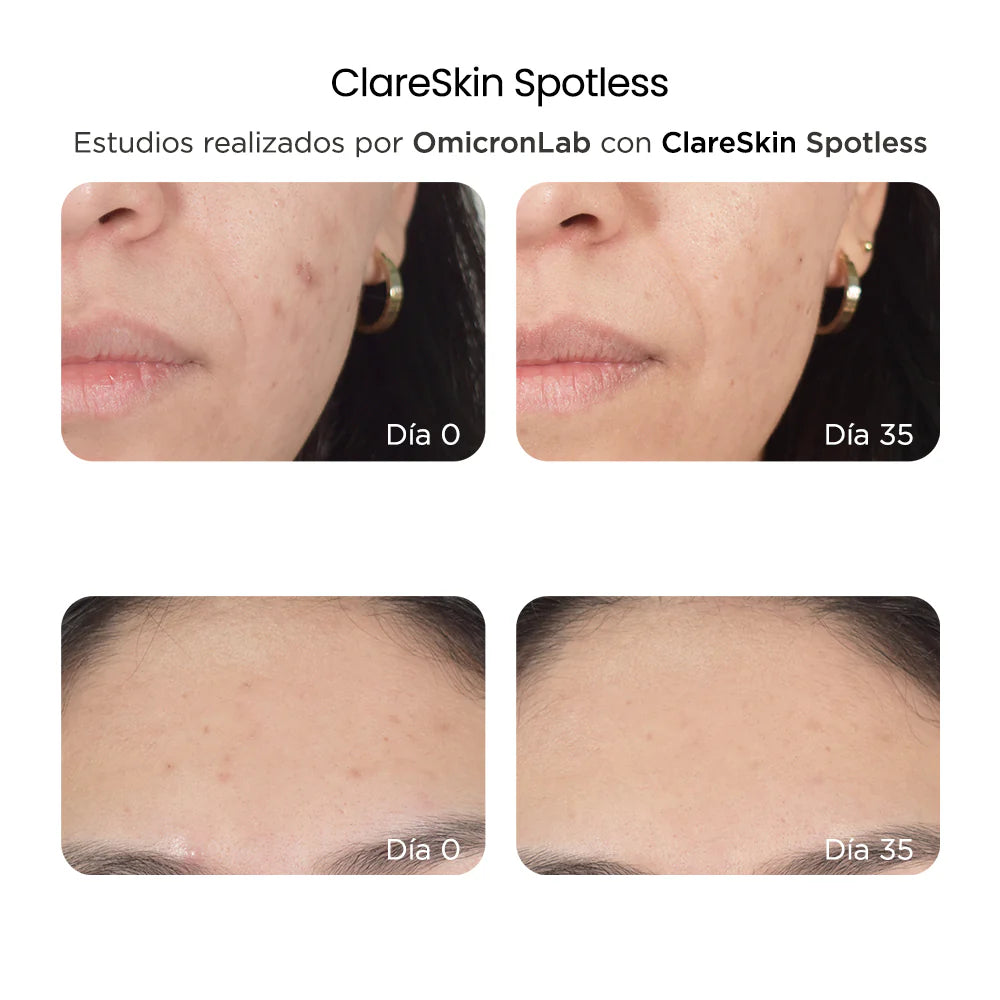 RÉVE ClareSkin spotless 30ml