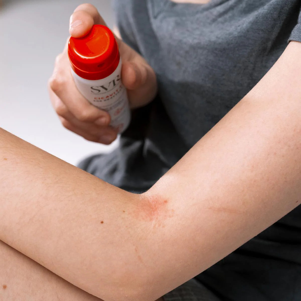 Outlet SVR Cicavit+ SOS grattage 40ml