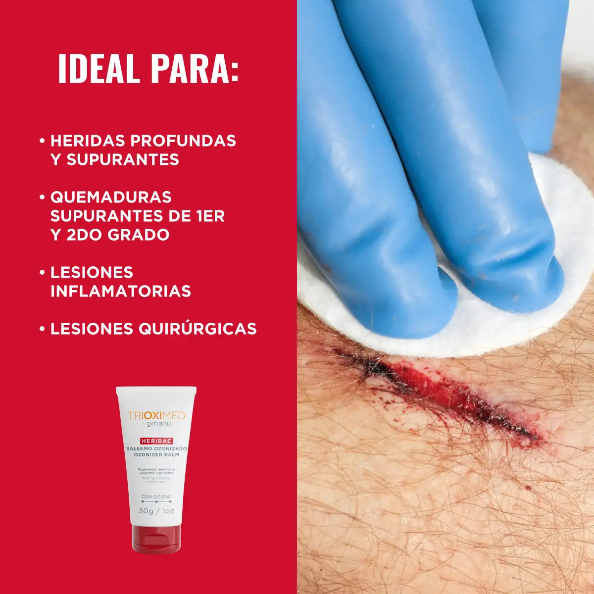 TRIOXIMED Heribac bálsamo ozonizado 30g