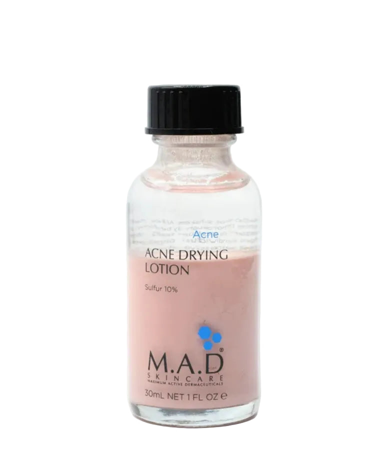 M.A.D. Acne Drying Lotion Sulfur 10% 30ml