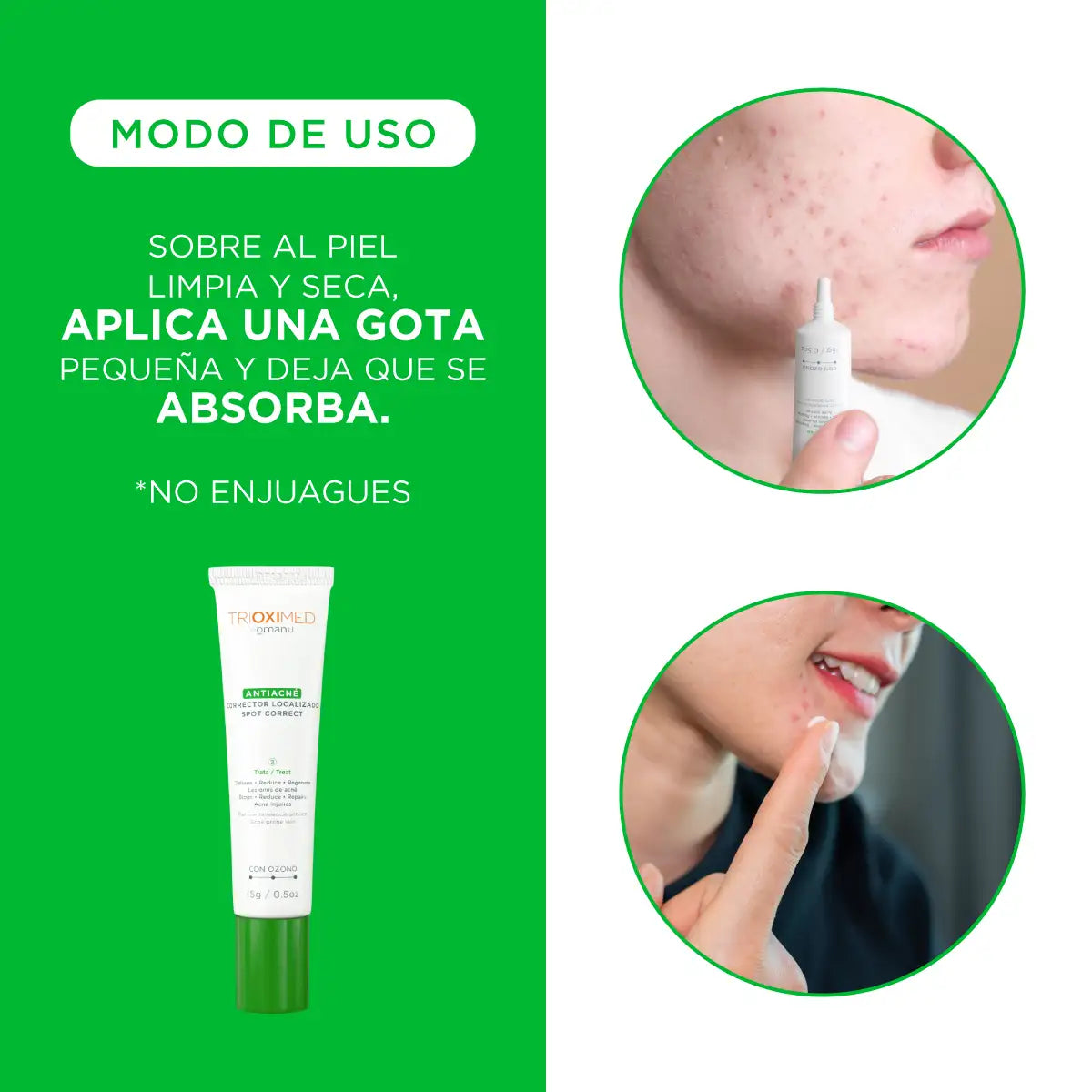TRIOXIMED Antiacné corrector localizado 15g