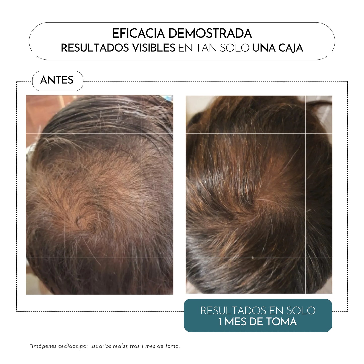 LUXMETIQUE Capilar formula 60caps